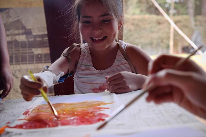 Carol, la niña guatemalteca que aprende a abrazar con nuevas extremidades