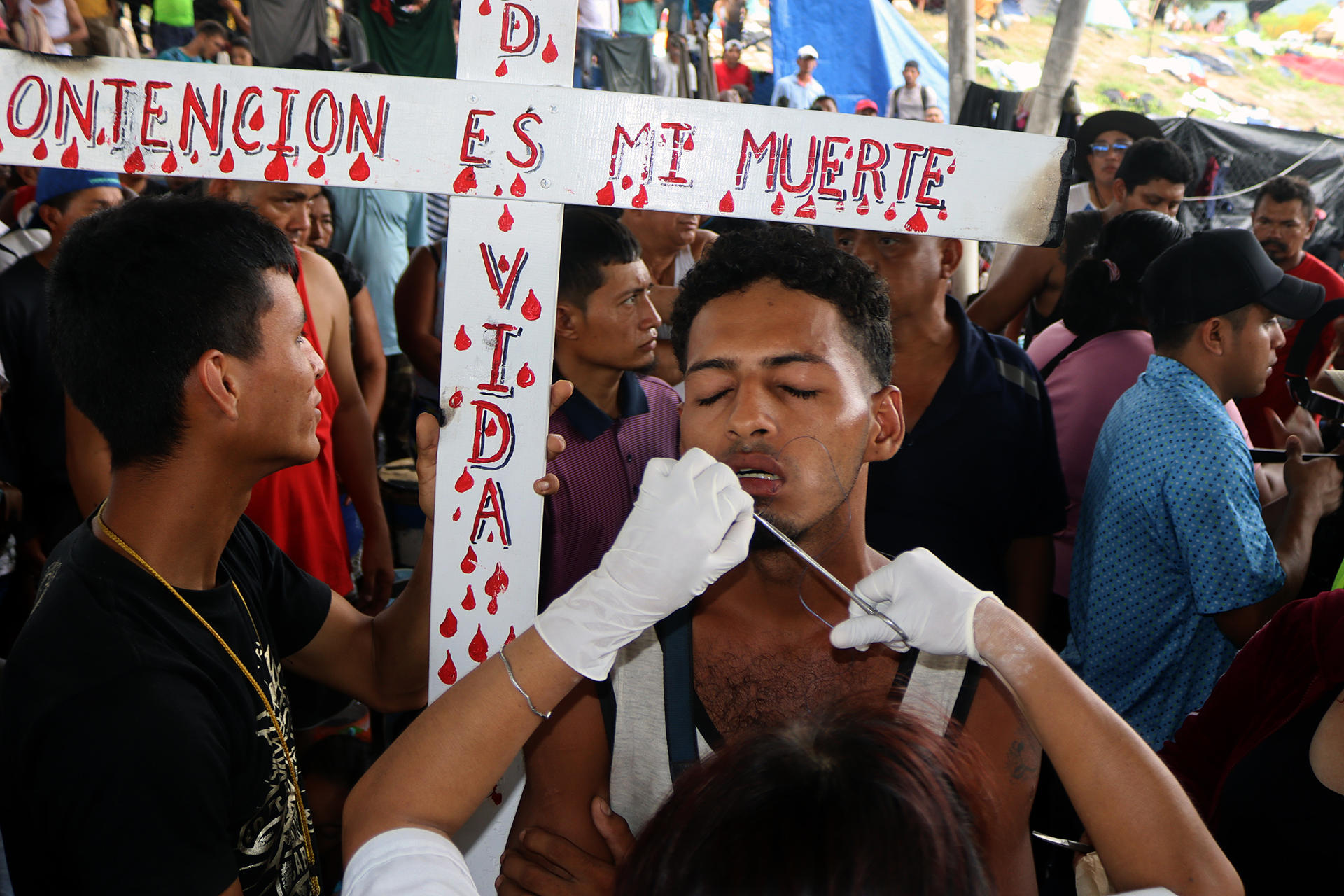 Fotografía de un migrante centroamerican con sus labios suturados, hoy, en la ciudad de Huixtla, en el estado de Chiapas (México). EFE/Juan Manuel Blanco
