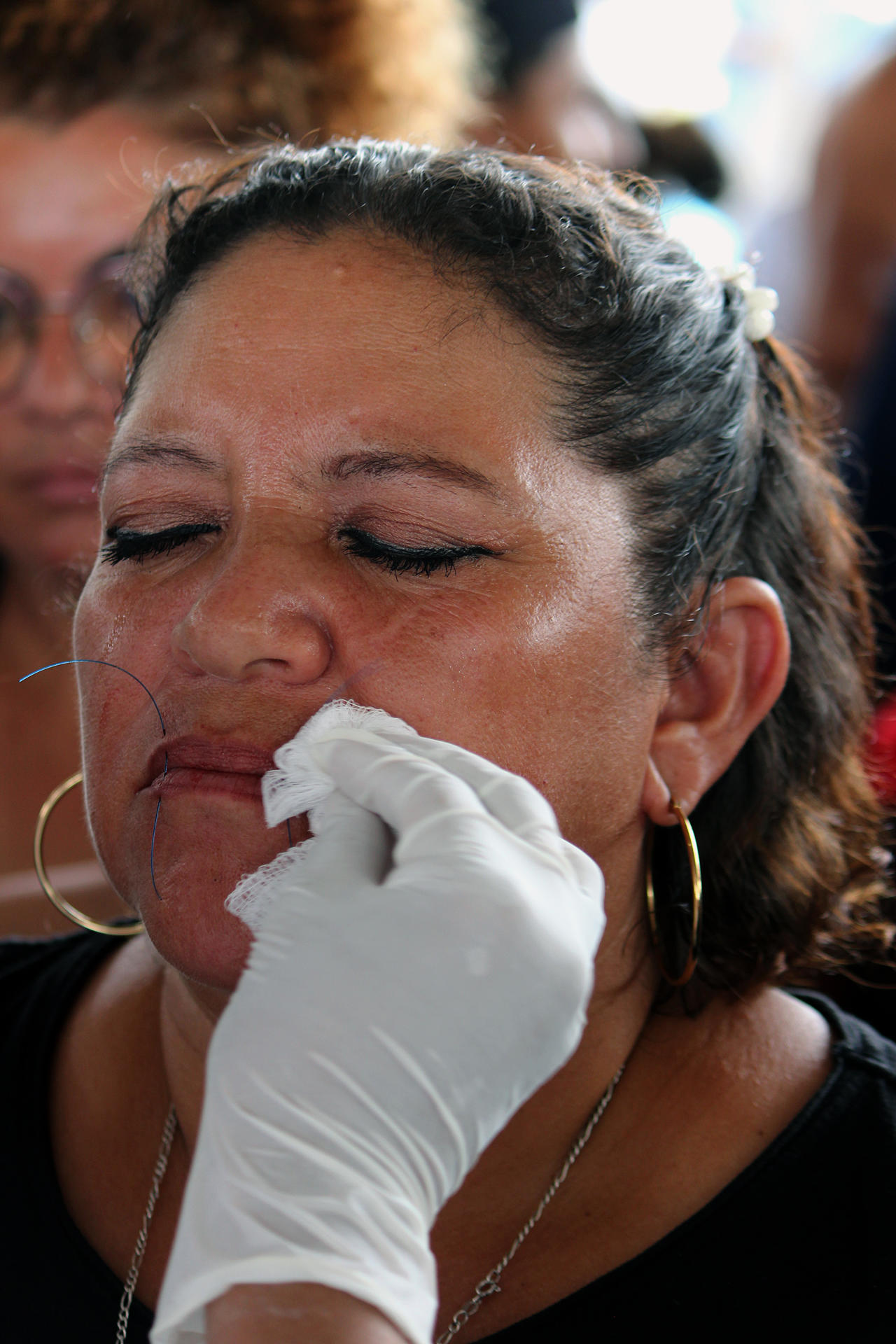 Fotografía de una migrante centroamericana con sus labios suturados, hoy, en la ciudad de Huixtla, en el estado de Chiapas (México). EFE/Juan Manuel Blanco
