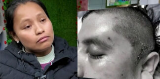 Muere un inmigrante mexicano en Nueva York tras casi siete años en coma por una agresión