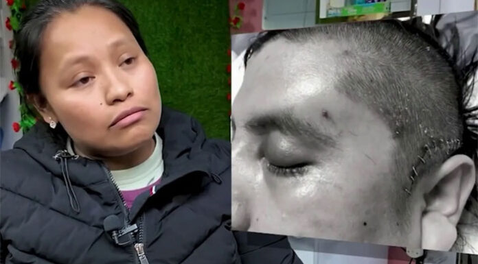 Muere un inmigrante mexicano en Nueva York tras casi siete años en coma por una agresión