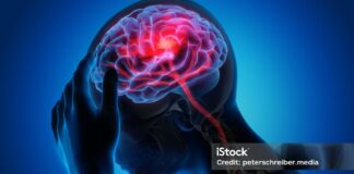 Un periodista hondureño es salvado en Urgencias de un hospital de Madrid tras sufrir un ictus cerebral